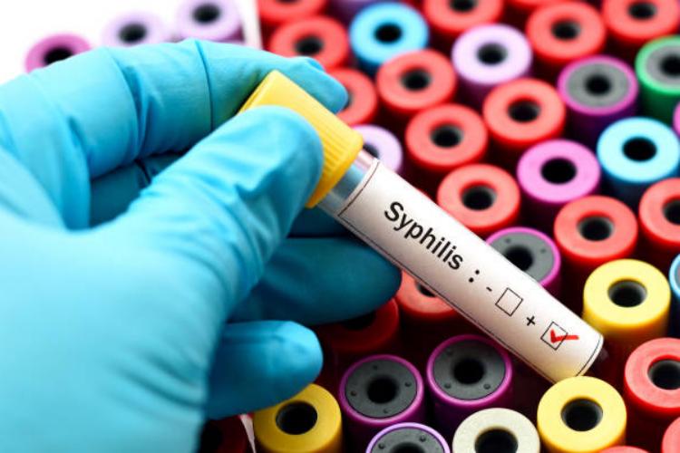 STIs Don’t Have to Ruin Your Sex Life – Here’s How to Handle Them